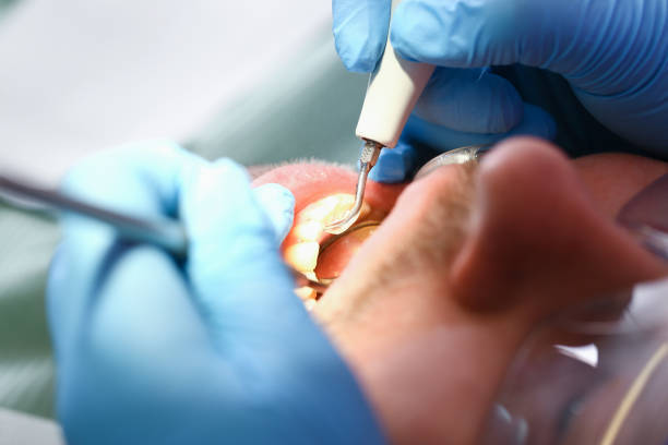 Best Emergency Dental Care for Broken or Chipped Teeth in Circle Pines, MN