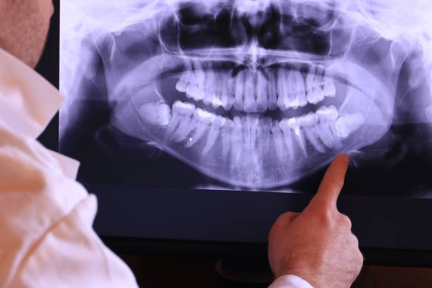 Best Emergency Treatment for Dental Infections or Abscesses in Circle Pines, MN