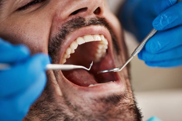 Best Emergency Gum Treatment in Circle Pines, MN