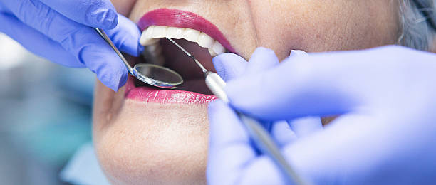 Best Emergency Root Canal Treatment in Circle Pines, MN